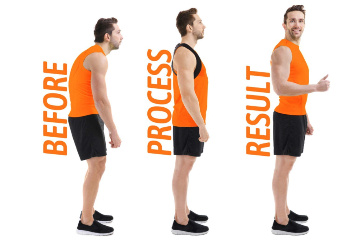 Posture Corrector